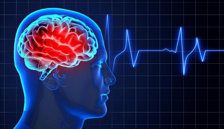 بیماری‌های مغز و اعصاب: علت‌ها، علائم، تشخیص و درمان